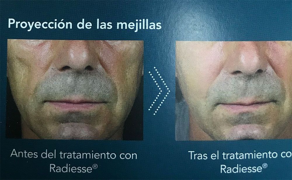 Fotos de tratamientos de estética