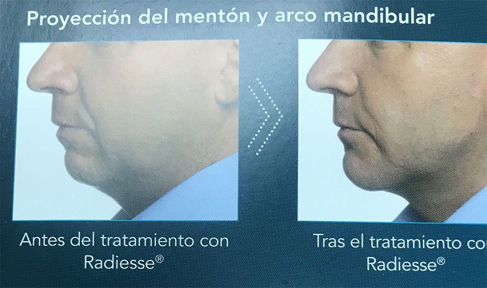 Fotos de tratamientos de estética