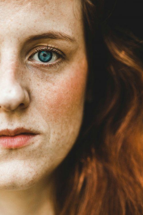 Eliminación de manchas en la piel en Valladolid