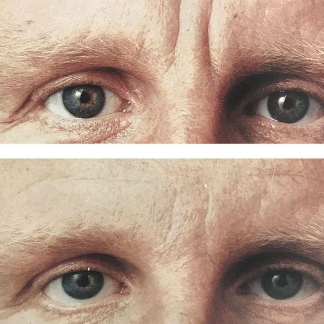 Clínica de estética en Valladolid